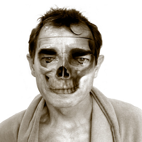 Wednesday March 28th (2007) Patient width=